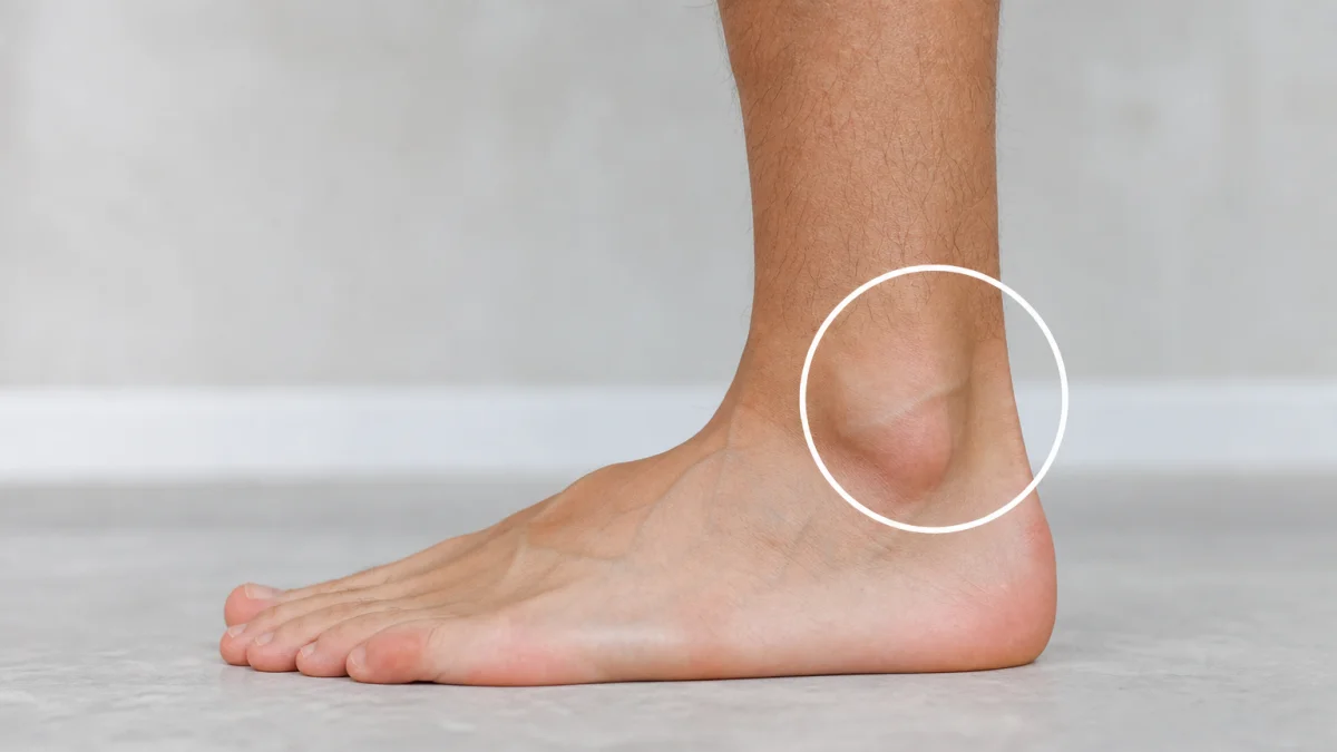 ankle meaning photo
