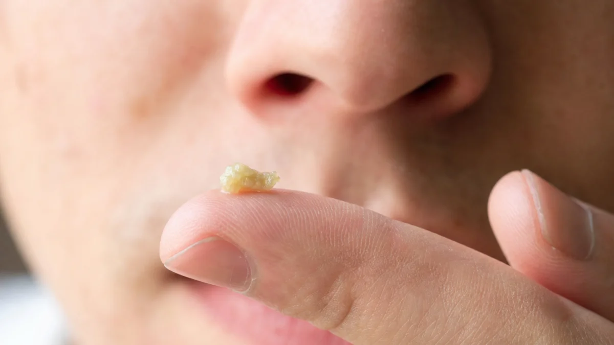 booger meaning photo